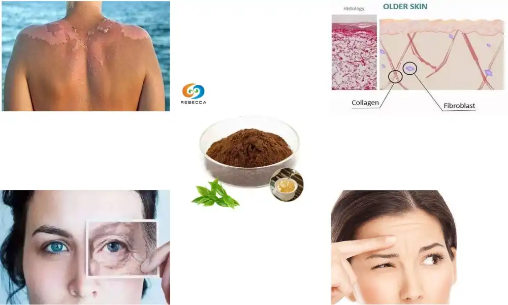 The benefits of green tea extract for skin